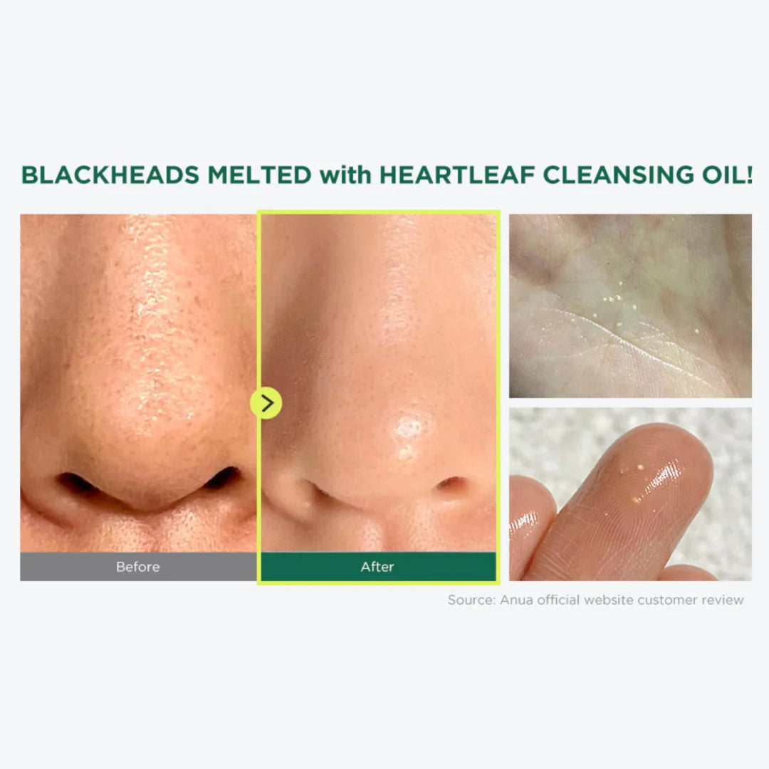 [Anua] Heartleaf Pore Control Cleansing Oil